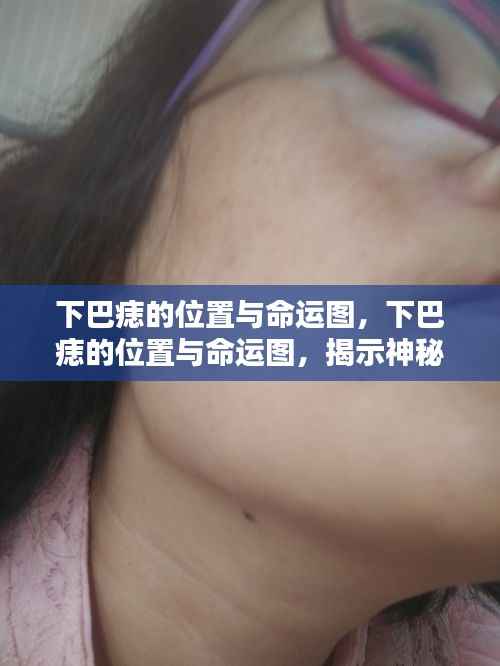 下巴痣位置与命运图解析,神秘联系揭秘