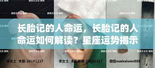 长胎记的人命运解读,星座运势揭示潜在影响与命运走向