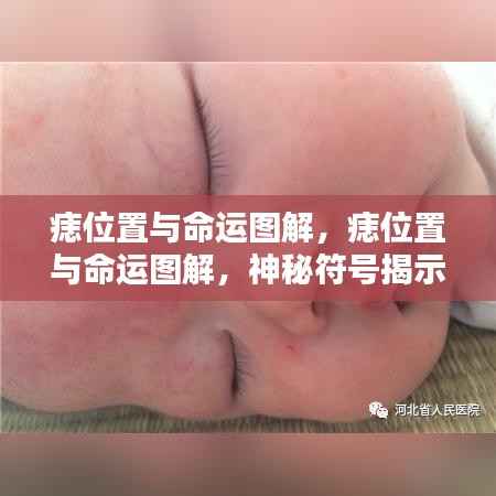 痣位置与命运图解,神秘符号揭示人生轨迹之谜