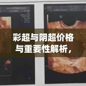 彩超与阴超价格与重要性解析,了解这些,选择更明智!